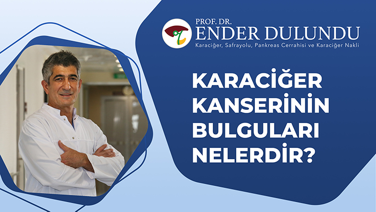 Karaciğer Kanserinin İlk Belirtileri Nelerdir