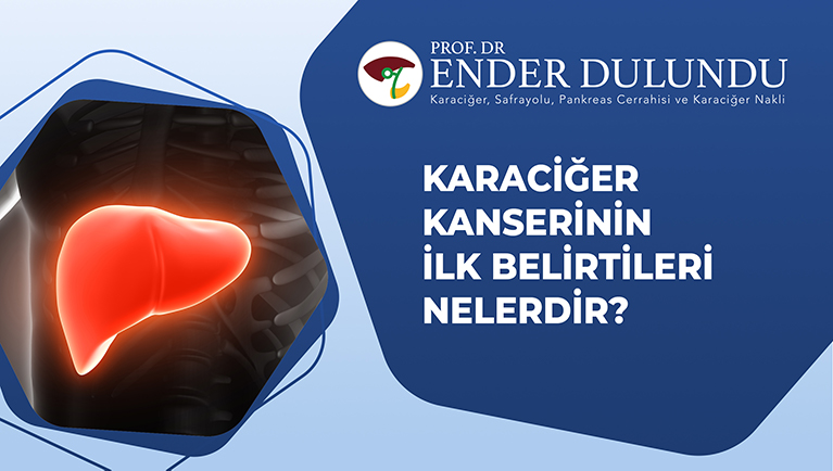 Karaciğer Kanserinin Bulguları Nelerdir?