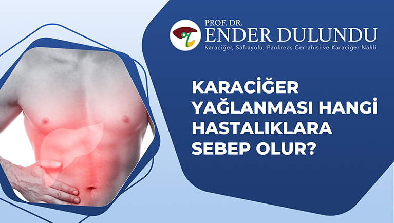 Karaciğer Yağlanması Hangi Hastalıklara Sebep Olur