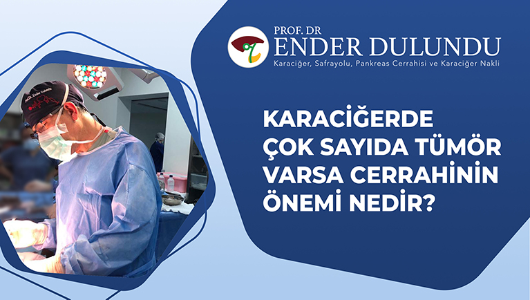 Karaciğerde Çok Sayıda Tümör Varsa Ameliyat Mümkün müdür? 