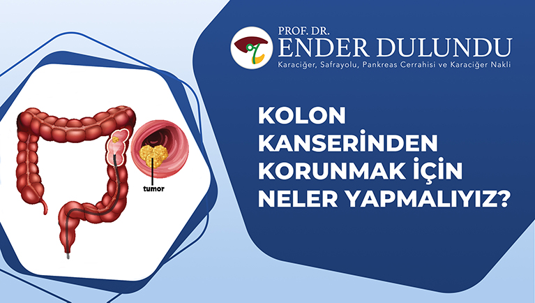 Kolon Kanserinden Korunmak İçin Neler Yapmalıyız