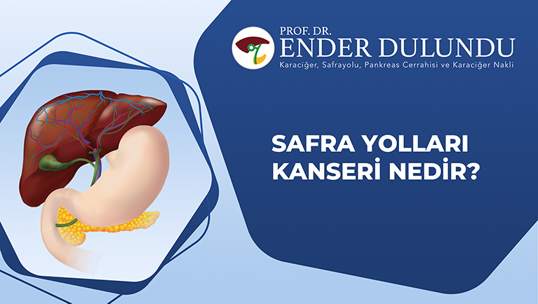 Safra Yolları Kanseri Nedir?