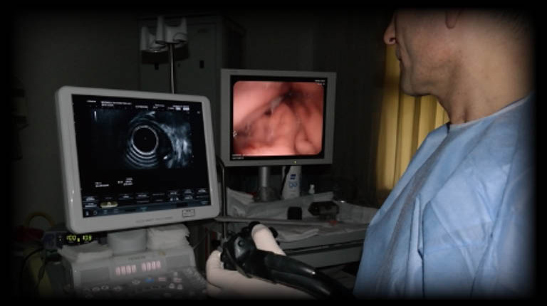 Ultrasonografi